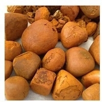 resources of Gallstones exporters